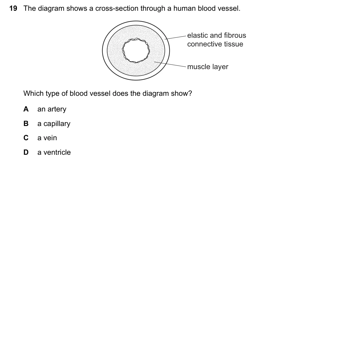 Question 19, November 2017, 0610 Paper 13