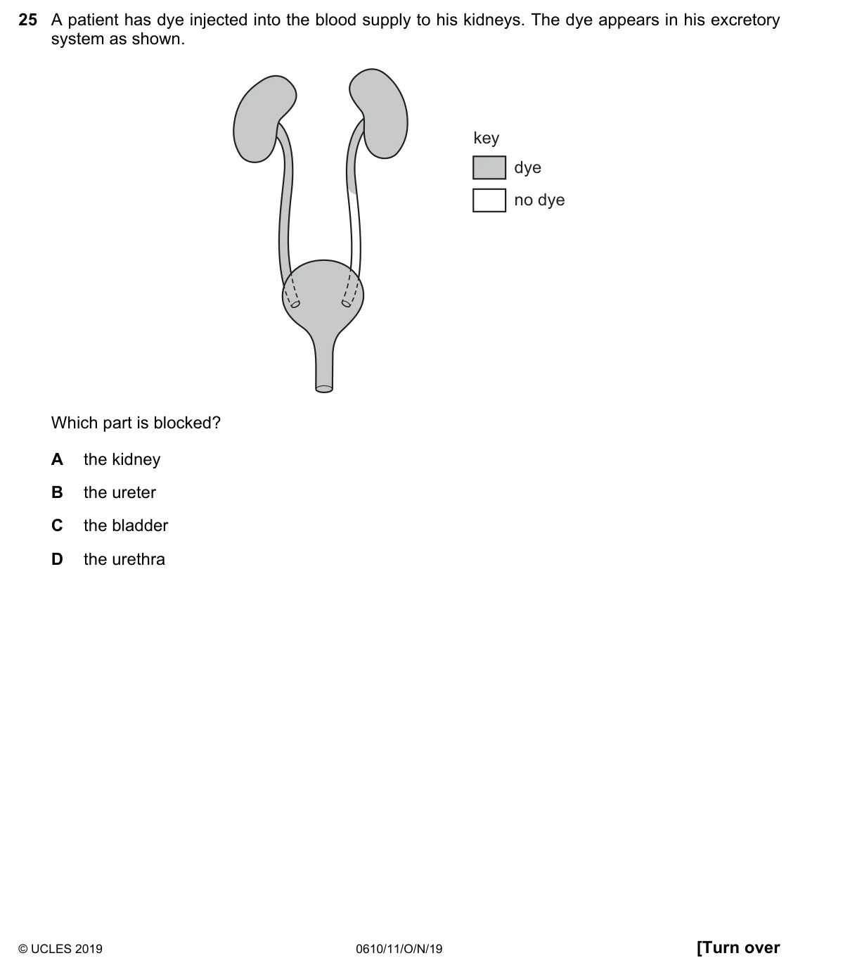 Question 25, November 2019, 0610 Paper 11