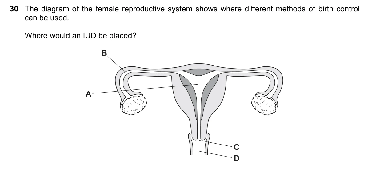 Question 30, June 2020, 0610 Paper 11